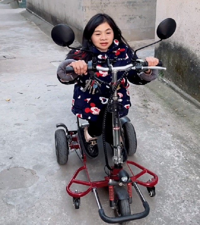 90厘米袖珍女孩,不顾医生反对执意生子,孩子三岁前已骨折过10次