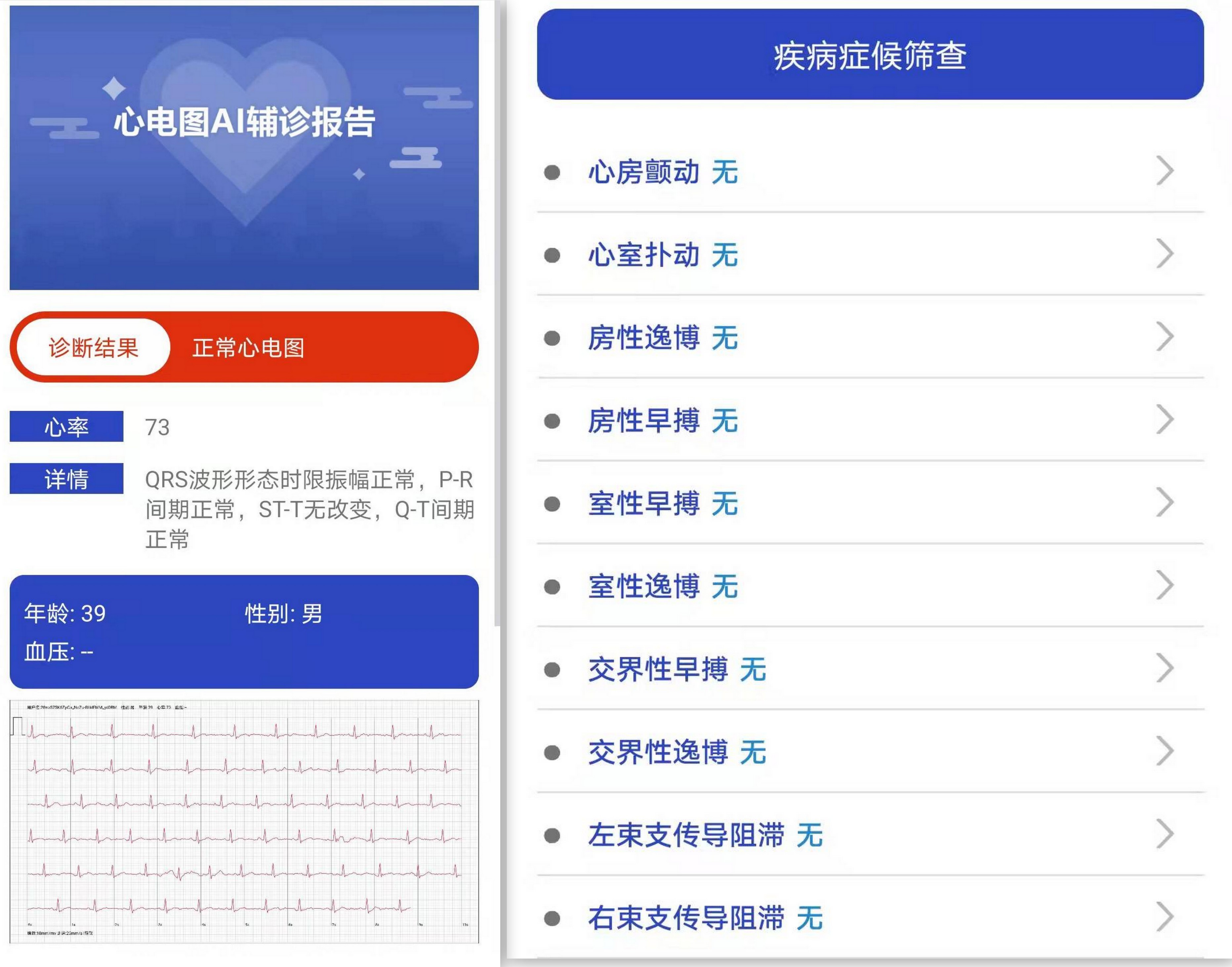 隨身小秘書(shū)，運(yùn)動(dòng)功能豐富，健康數(shù)據(jù)隨時(shí)掌握，dido E10手表體驗(yàn)