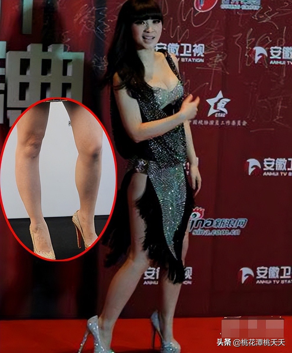 粗腿、短腿、罗圈腿，这8位女星貌美如花，却“输”在了大腿上