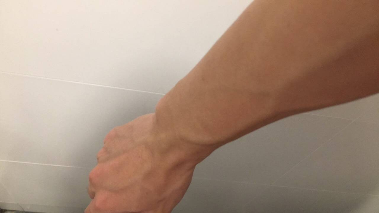 手上有很多青筋凸起，是因为毒素积累导致的吗？看看不一样的说法
