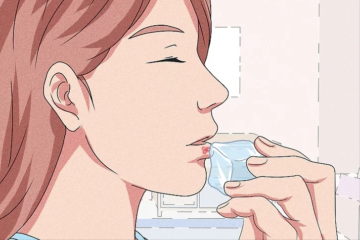 嘴角起泡怎么办？快速消泡方法大揭秘