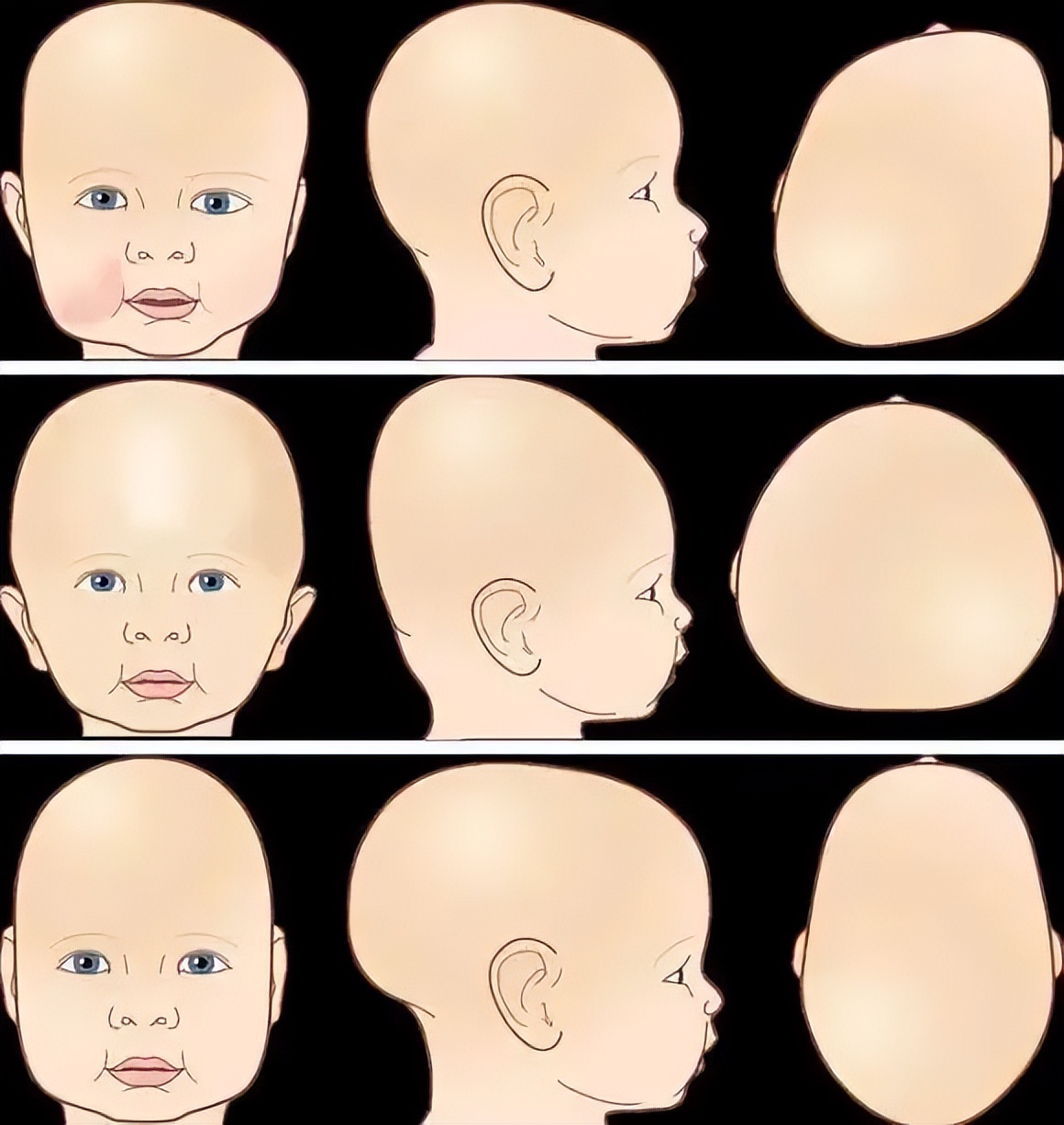 婴儿菱形头型图片图片