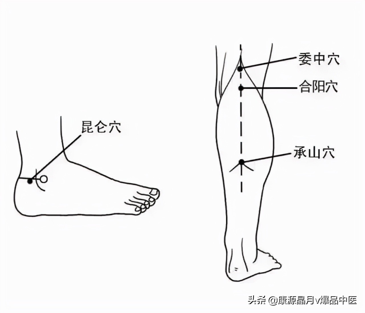 穴位就是中药，经络就是药房！太有用了！收藏吧