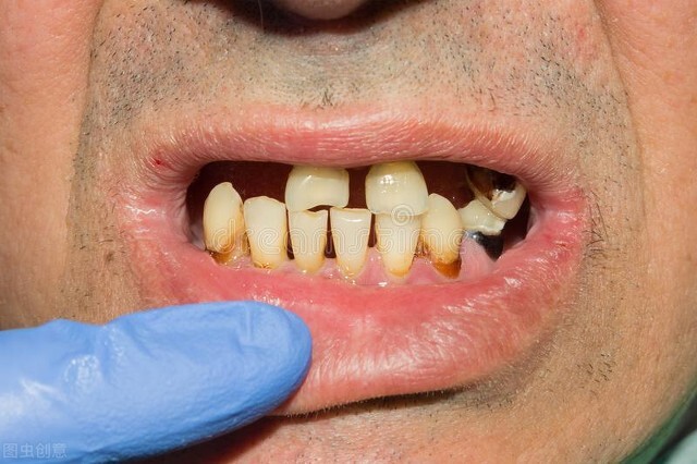 老人的牙齿只剩几颗，要不要全拔了再镶新牙？牙医告诉你答案