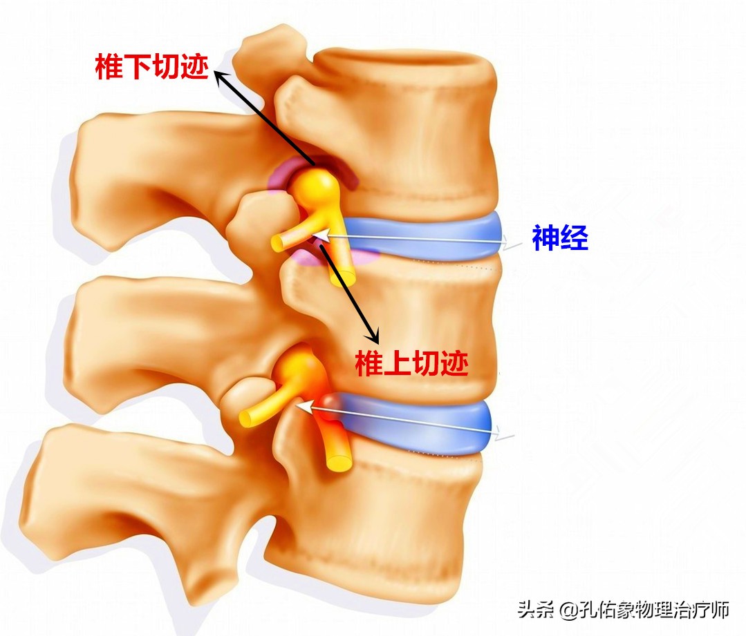 患了頸椎病,會有哪些症狀?該如何治療?