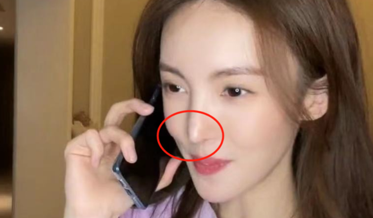 演艺圈“花式鼻子”大比拼，又尖又翘又吓人，一个比一个精彩