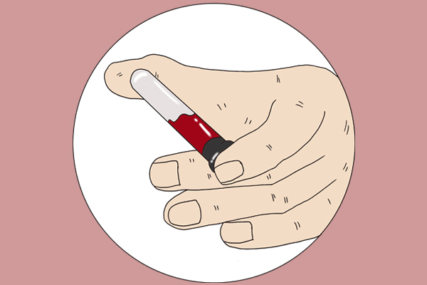 尿毒症上身，身体会有“2臭1痒1高”的提醒，望你能早点留意到