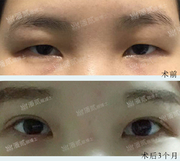 苦命女人面相图片 眉骨高突的面相_达一风水网
