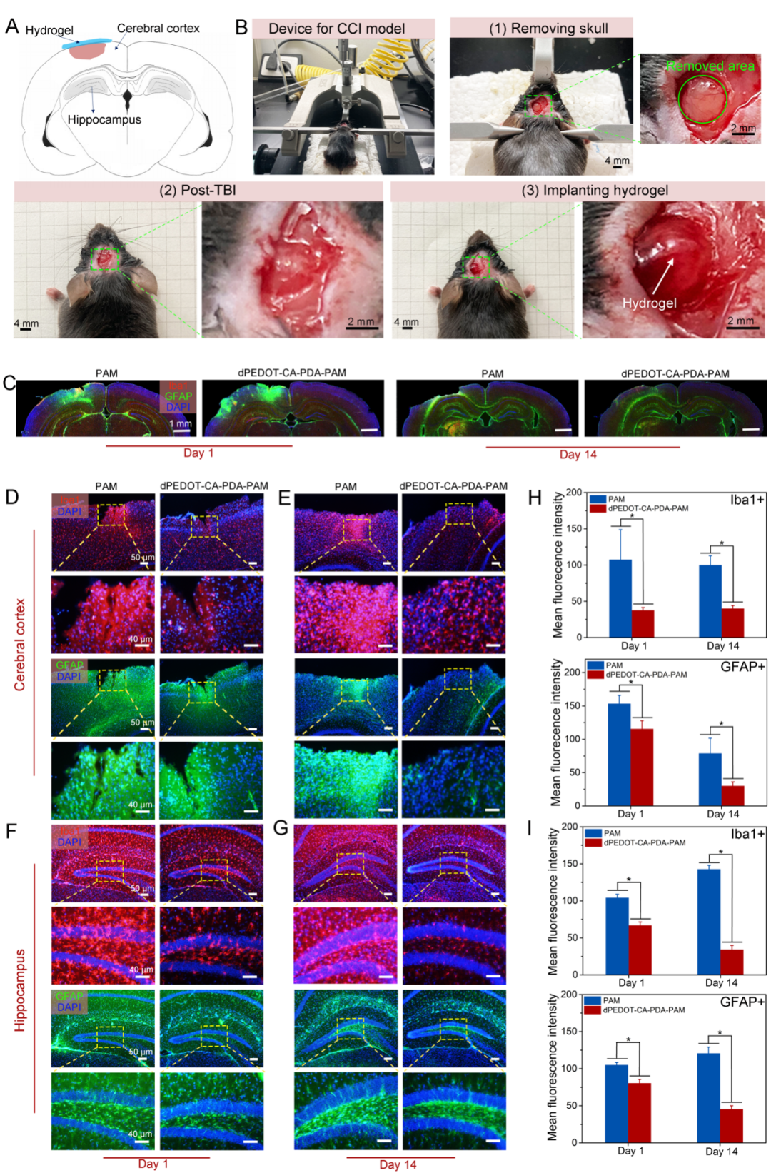 中国科学家研发柔性脑机接口，在10Hz左右找到α波