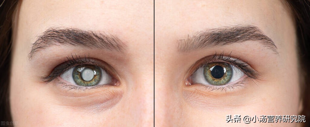 最新研究：吃綠葉蔬菜和葉黃素對眼部、心血管等4方面健康有幫助