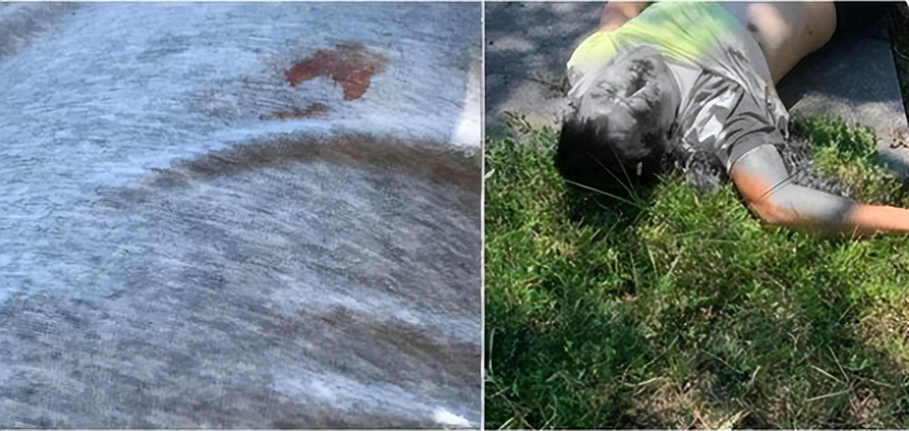 林志颖最新病况！弟弟称已经清醒了，疑似还有颅内出血