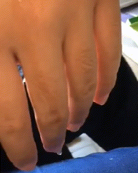 我妈让我把鱼解冻，结果打游戏没注意煮熟了怎么办？