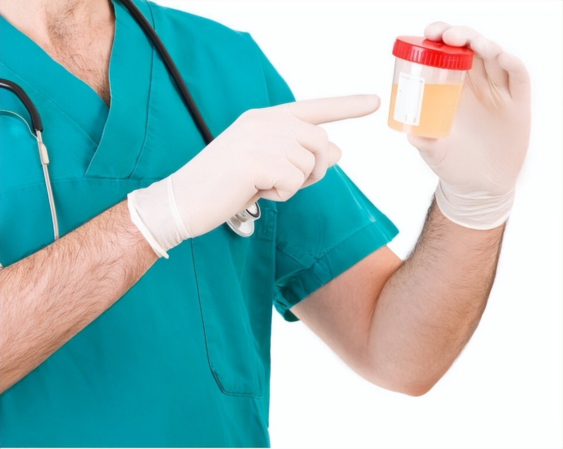 尿酸“超标”，身体会出现4个“信号”，占一个，也要开始控制