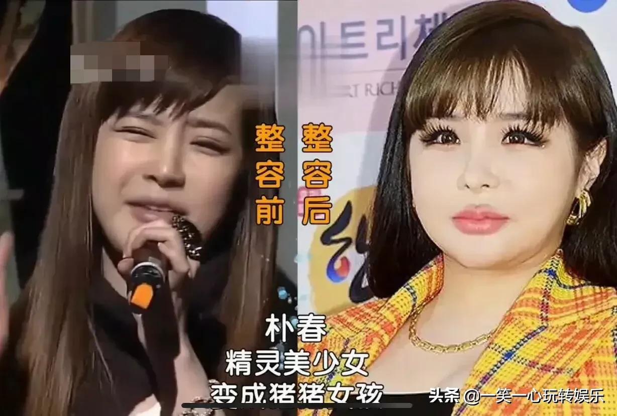 韩国明星变美“后遗症”，朴春360度崩盘，李多海变僵尸脸
