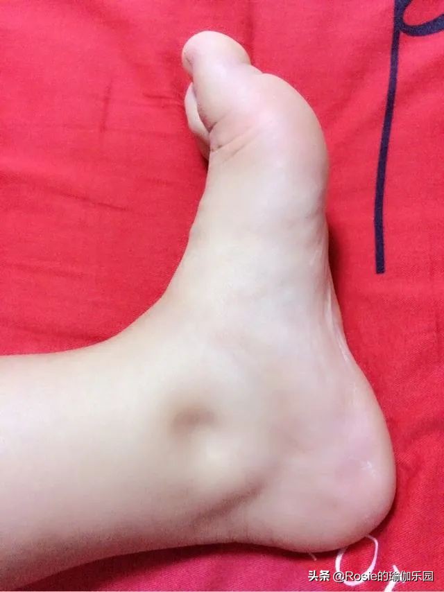 脚踝粗不自信，4步带你瘦腿瘦小脚踝，像阿雅一样自信成女王