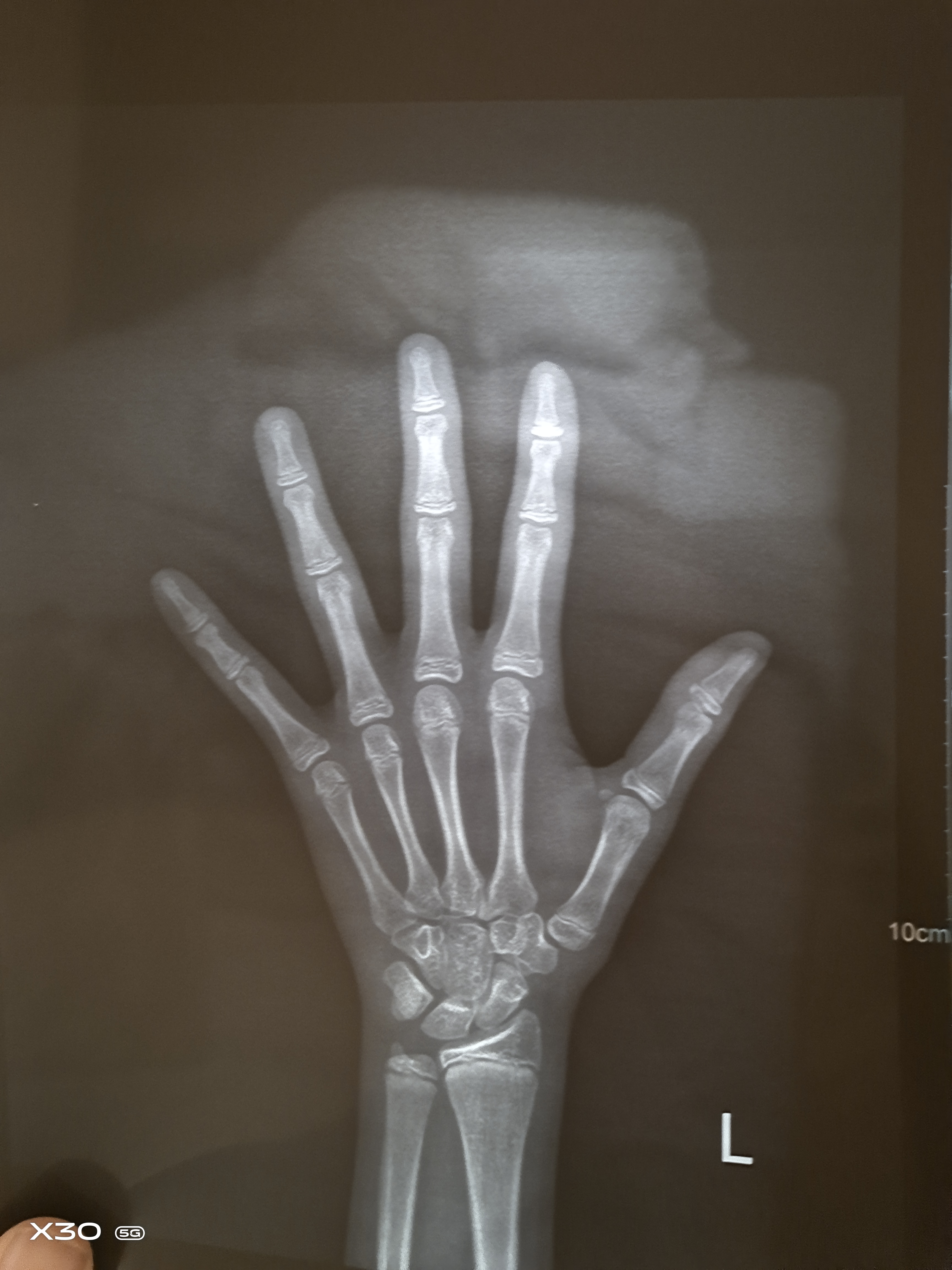 儿童标准身高参照表，男孩女孩都有，评估下你家孩子的身高水平