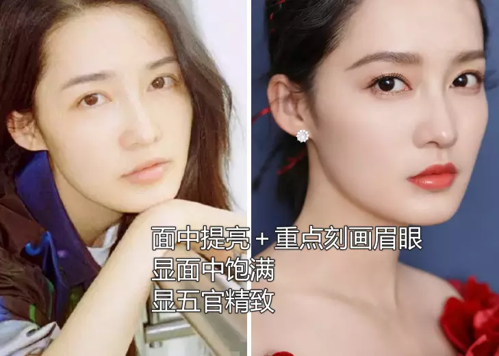 鼻子塌不可怕，面中凹才拉胯，显苦显凶还显老，许多女星深受其害