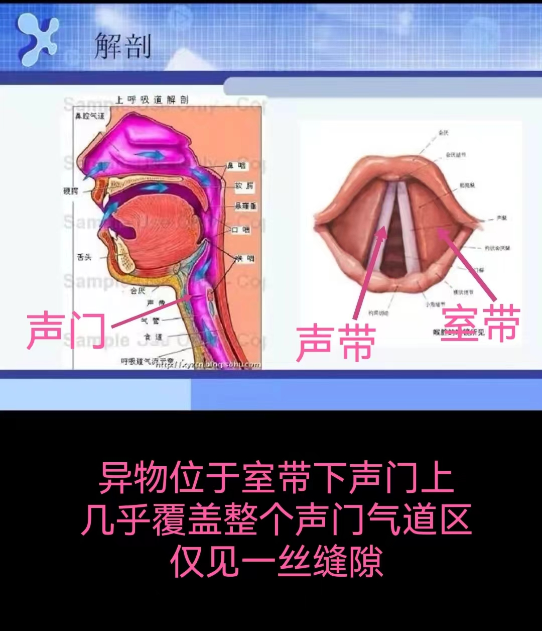 “喝水”也会卡喉