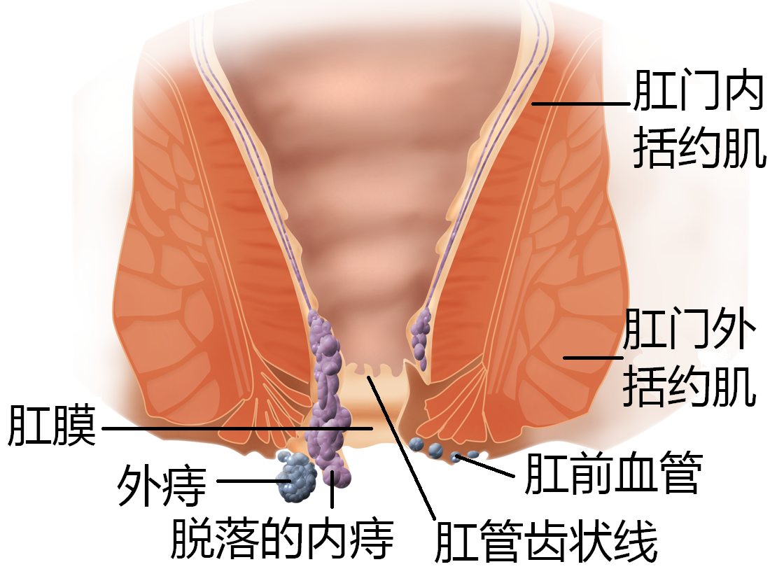 总觉得大便拉不干净、擦不干净，请留意5种病，医生教你如何缓解