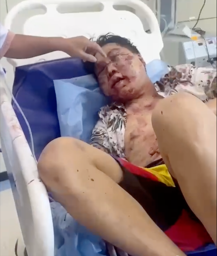 31岁湖南小伙在柬埔寨出车祸生命垂危：同胞彻夜看护、纷纷捐款