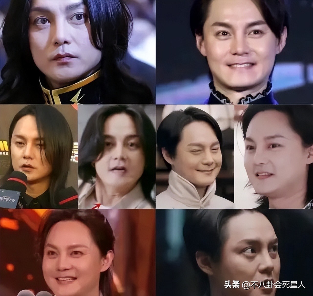 内娱新晋“发面馒头”，肿胀僵硬没眼看，让动脸前辈们自愧不如