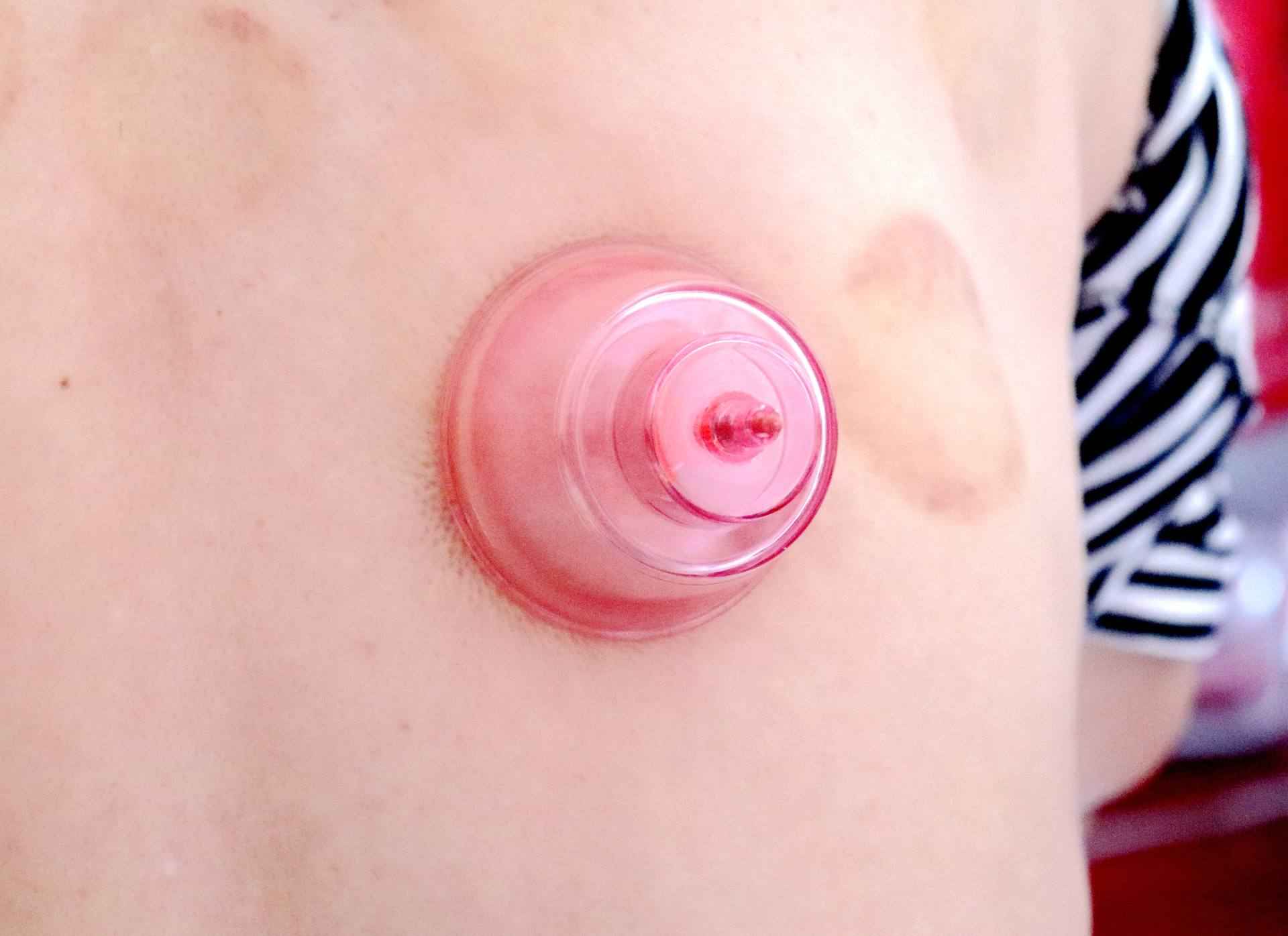 养生好帮手——左点走罐按摩器