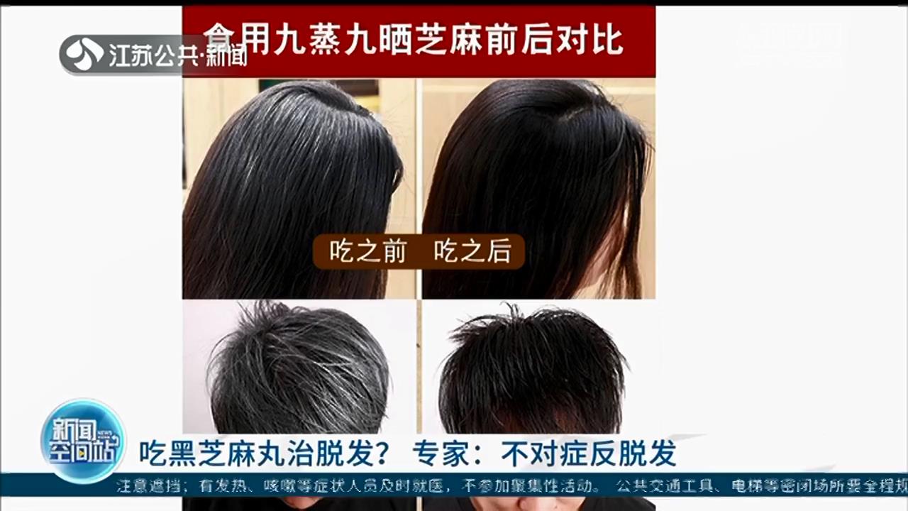 吃黑芝麻丸治脱发？专家：不对症，反而助推脱发