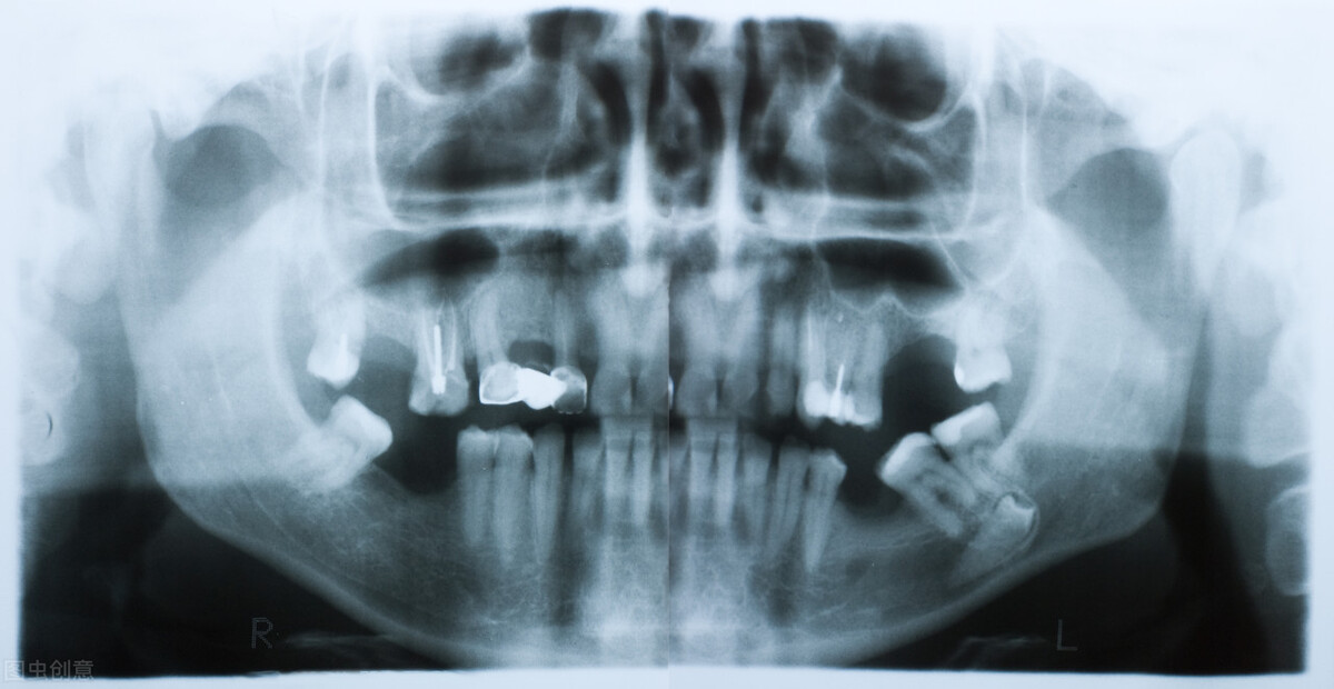 知名牙医大声反驳：谁再说拍牙片是坑钱，都给我过来