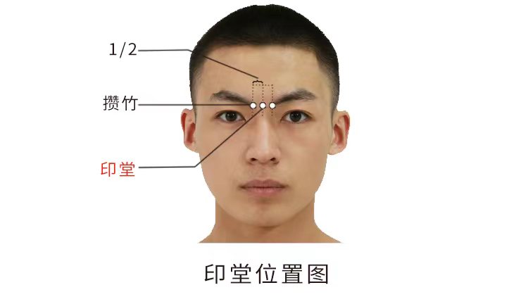 睡眠不好可以試試按揉這兩個穴位