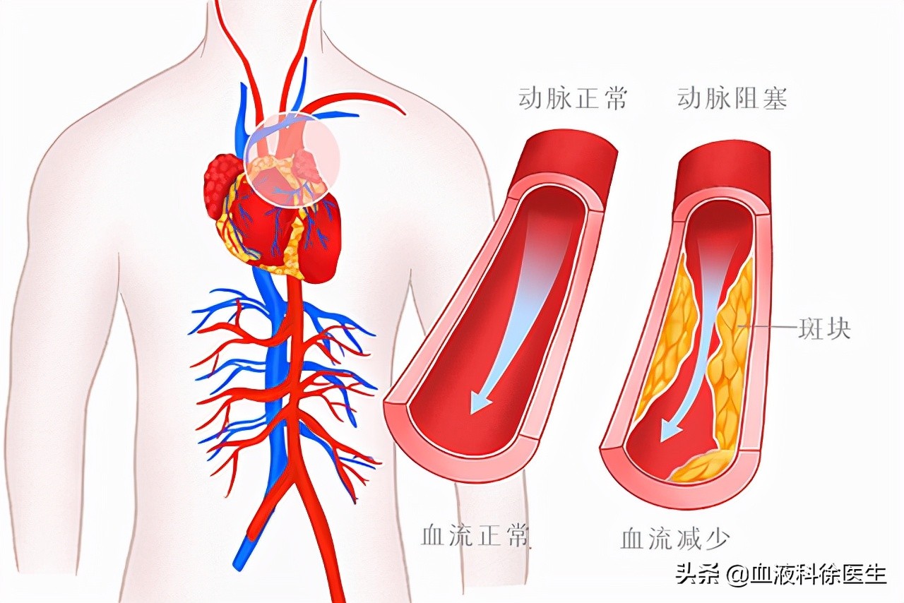 血液粘稠怎么调理？