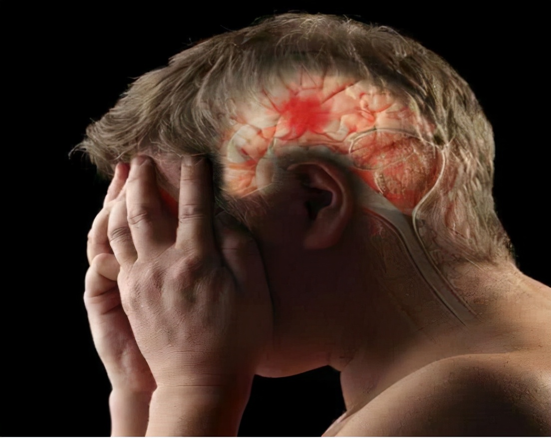 脑梗塞后有多大几率能恢复如初?医生:与这5个因素有很大关系