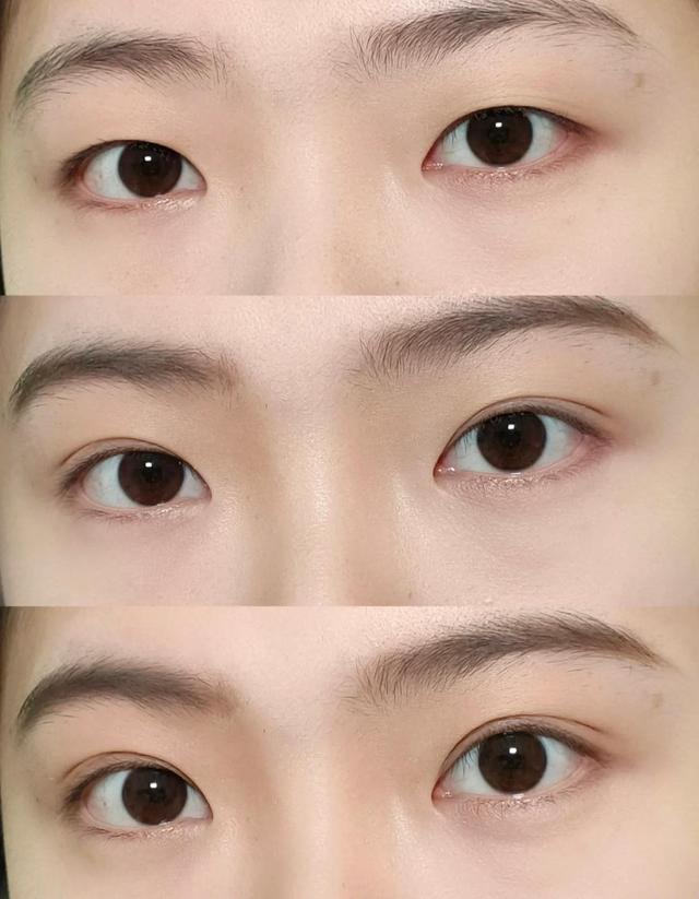 三白眼图片(割得双眼皮和天生的双眼皮) - 赤虎壹号