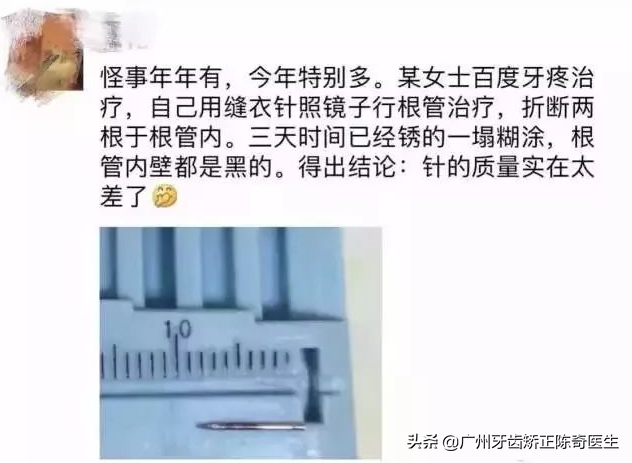 神操作！DIY看牙，自己动手给自己拔牙补牙矫牙等