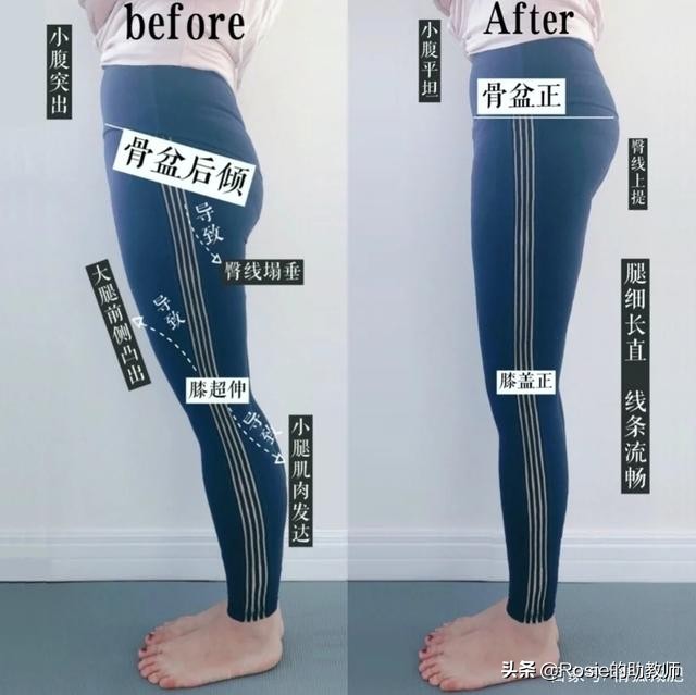 何穗晒照胳膊小腿一样粗，小腿粗壮弯如何瘦？找对成因这样做