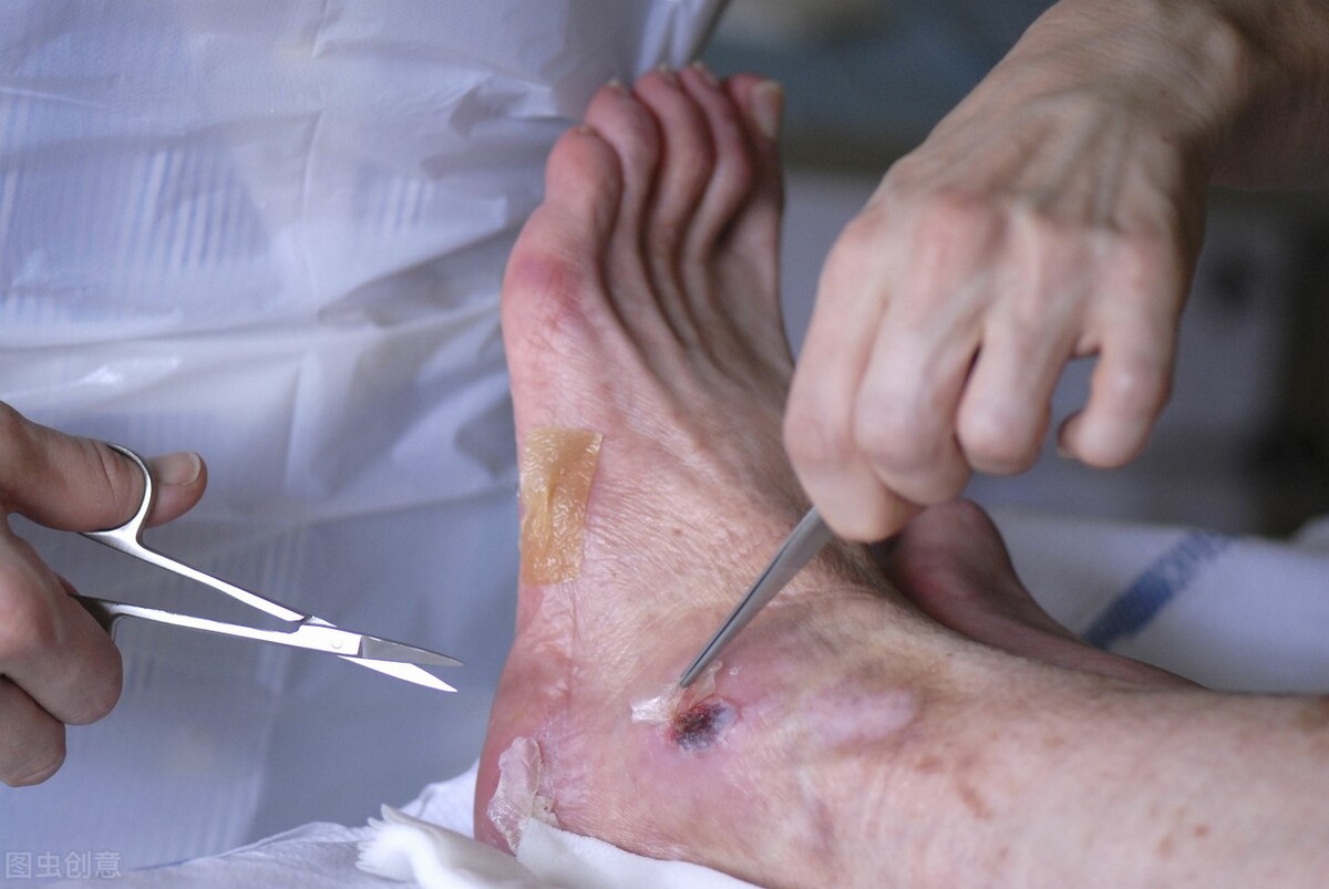 身体好不好，低头看看脚！双脚出现这些症状，或是健康“警报器”