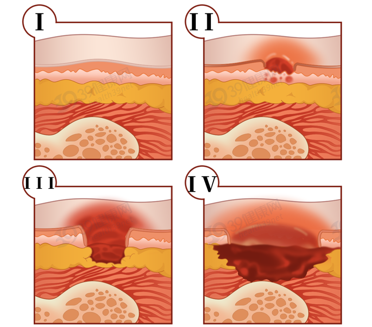 久坐对人体有什么危害？可能会得3种病，经常坐着的人看看吧