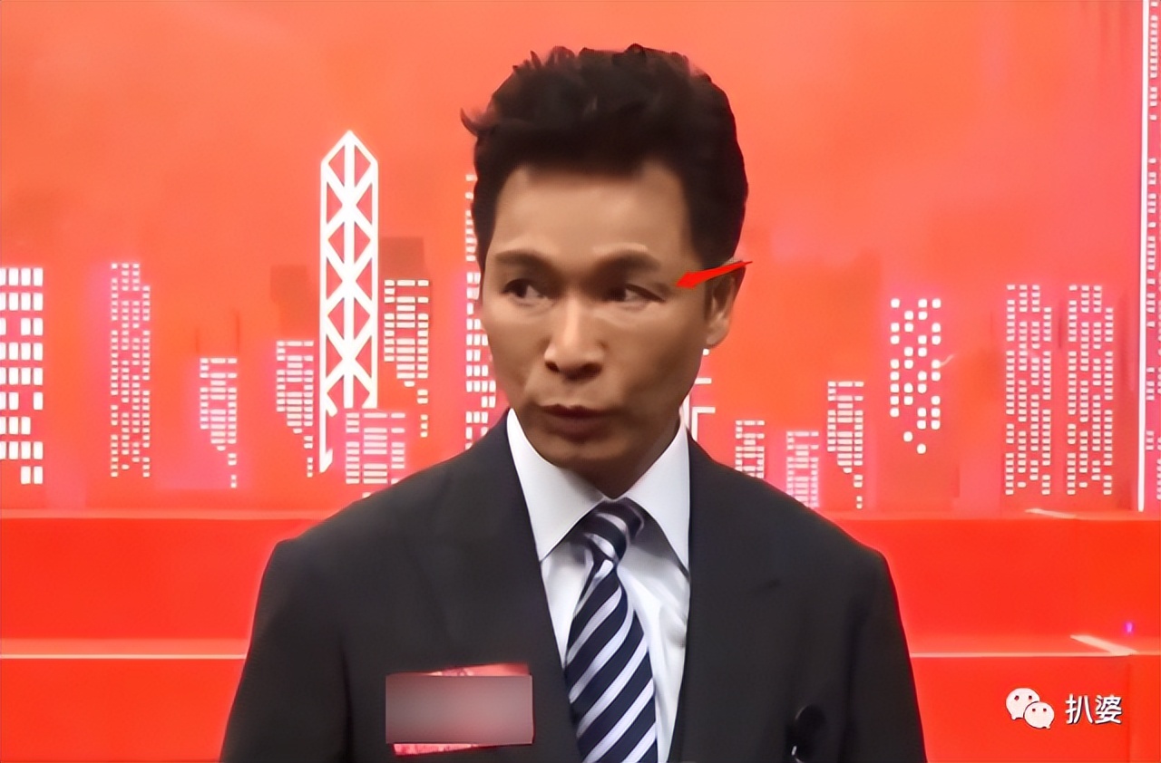 他的颜值毁了，原因好唏嘘