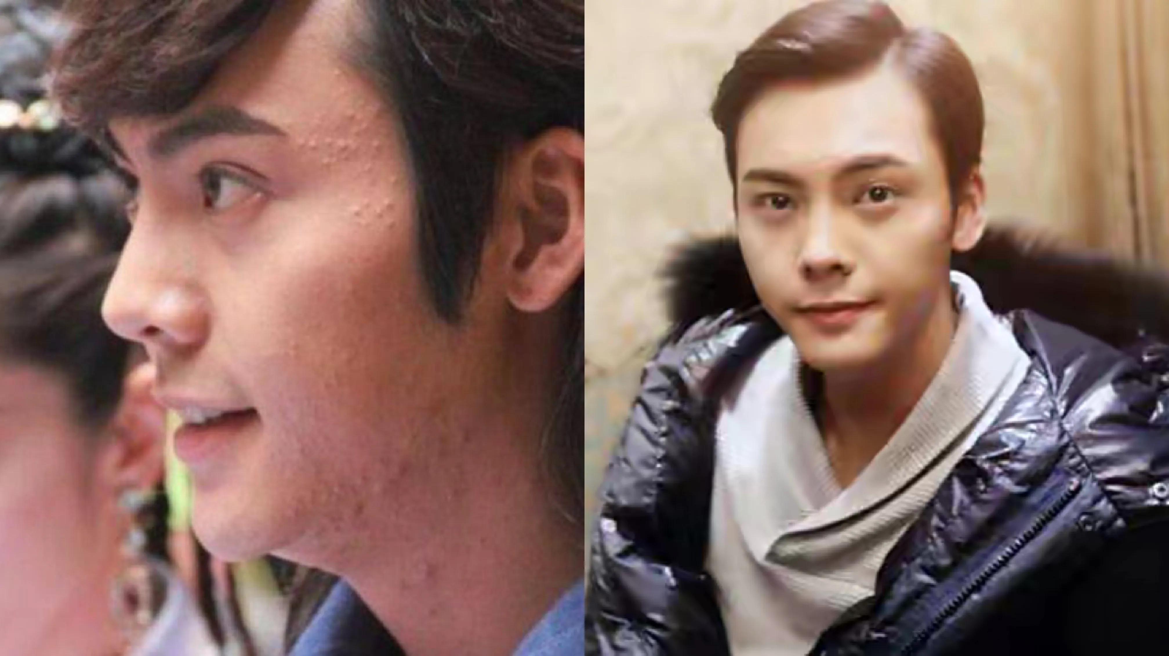 男明星未修图照片，看完你还喜欢他吗？