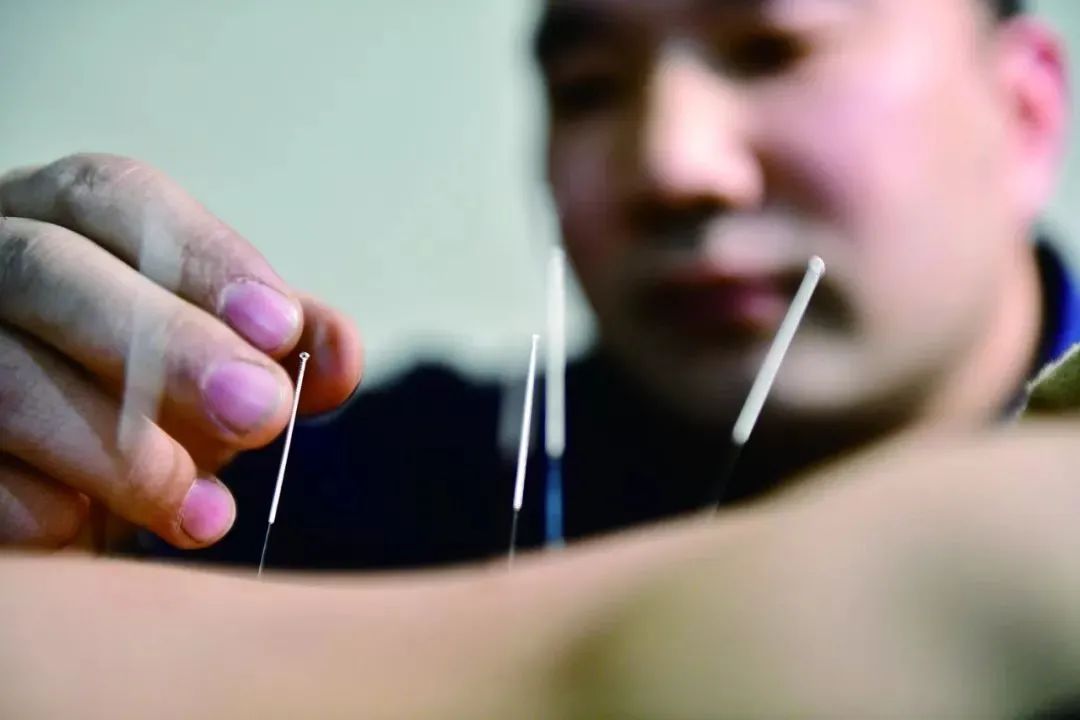 为什么非物质文化遗产对中医专长医师考试有加分？