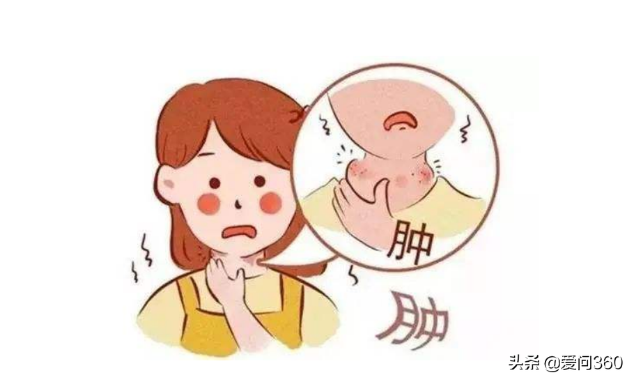 甲状腺有问题的几个表现，预防甲状腺结节的小妙招，你知道几个？