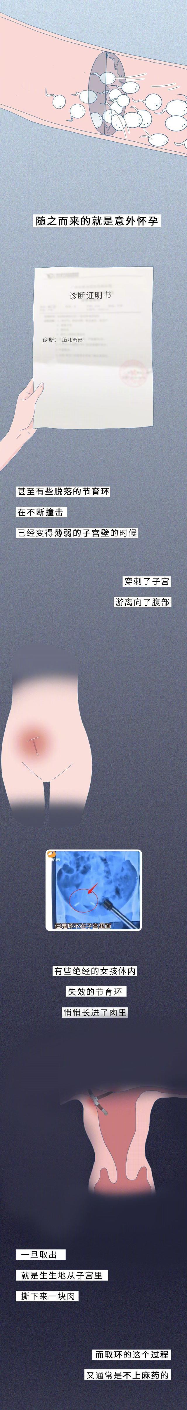 “节育环”长时间在女人体内，会发生什么变化？