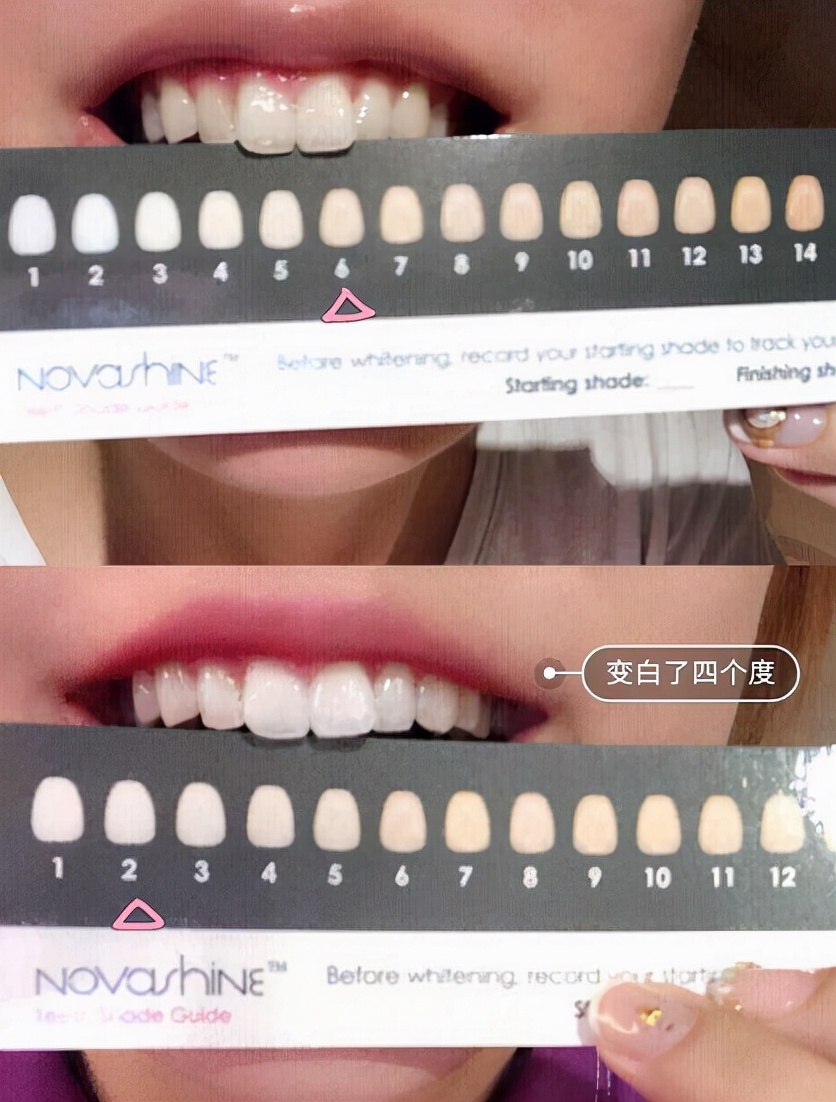 为什么口臭的人自己闻不到？教你正确做法，呼吸都是“甜”的