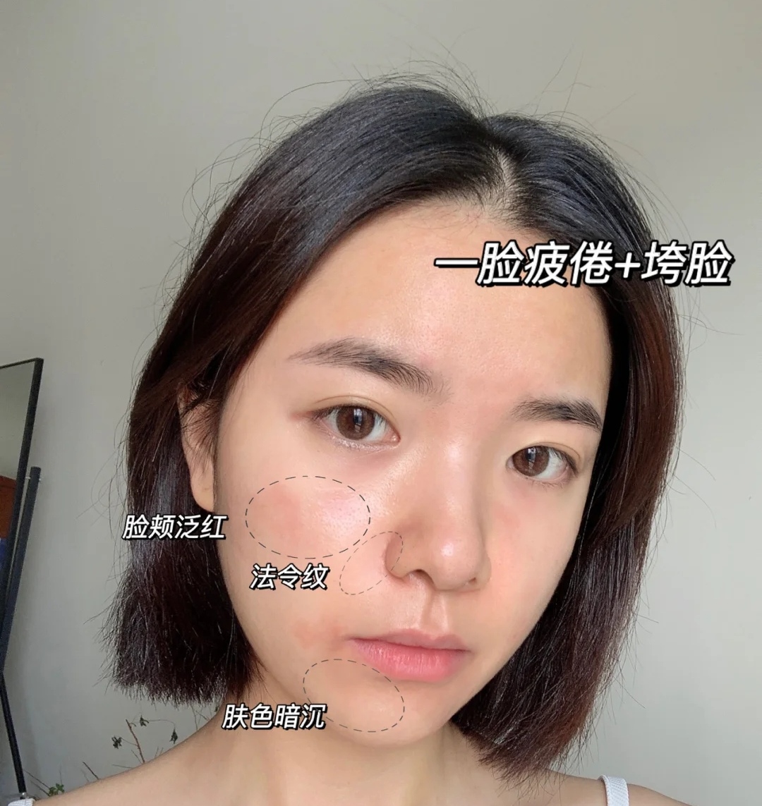 早C晚A这阵风你跟了吗？其一建立耐受，重在防反黑，不可操之过急