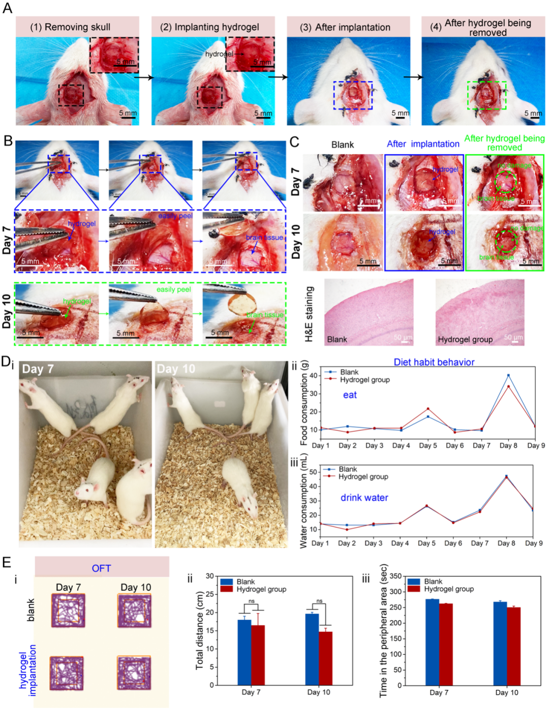 中国科学家研发柔性脑机接口，在10Hz左右找到α波