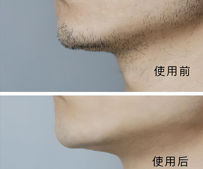 口碑最好的剃须刀（盘点十大小巧便携剃须避免踩雷）