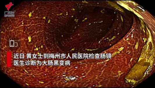 左旋肉堿十大品牌,左旋肉堿十大品牌網