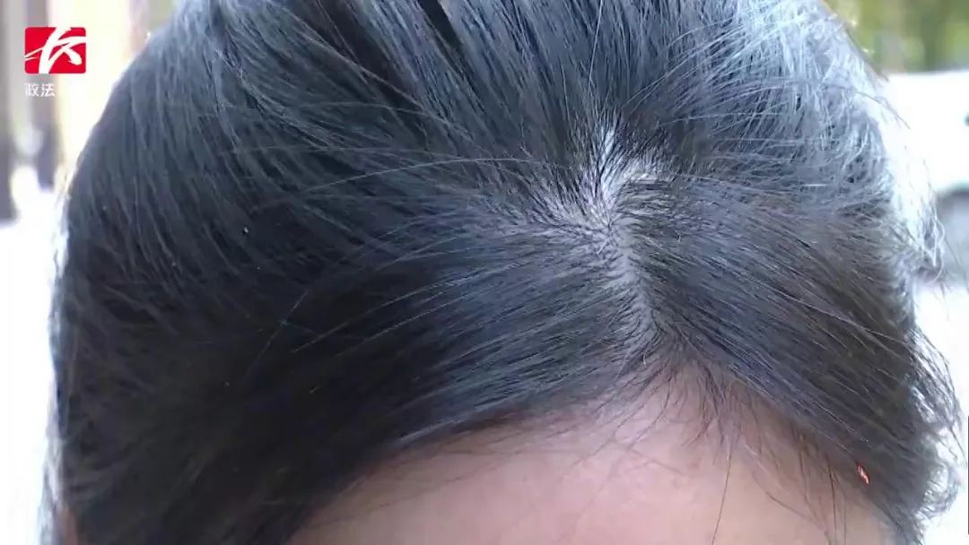 白转黑养发馆效果排行榜：哪些品牌真正有效？