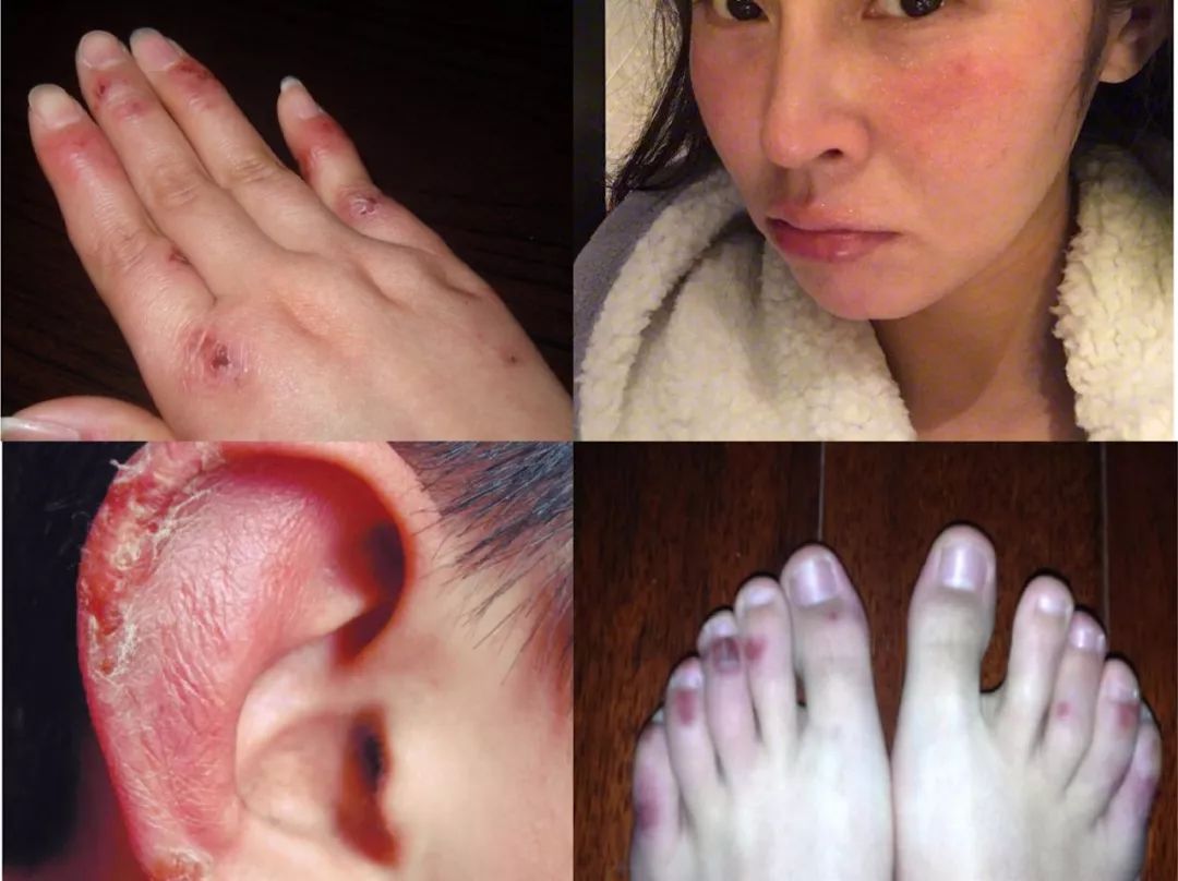 南药本草蛇油修护膏,五大植物萃取,补水美白修护一步到位