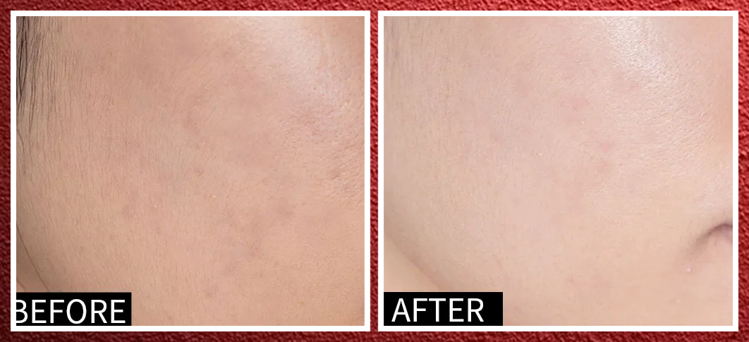 性价比超高的面膜，我终于帮你们找到了