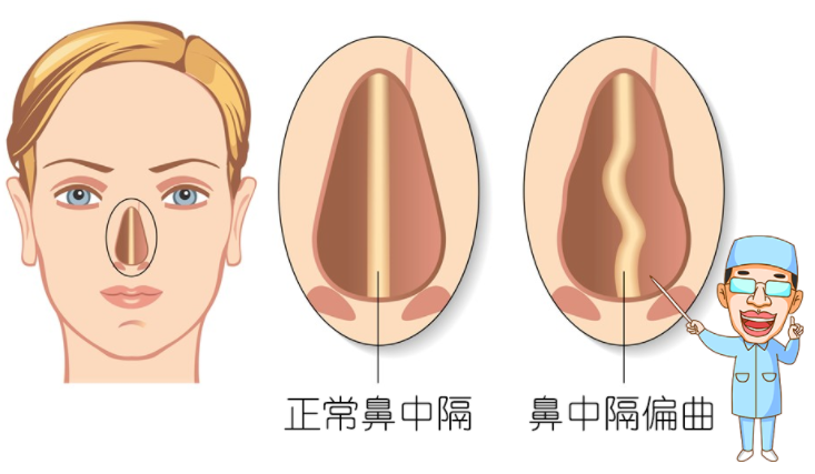 问题鼻型盘点，看看有没有你的同款？